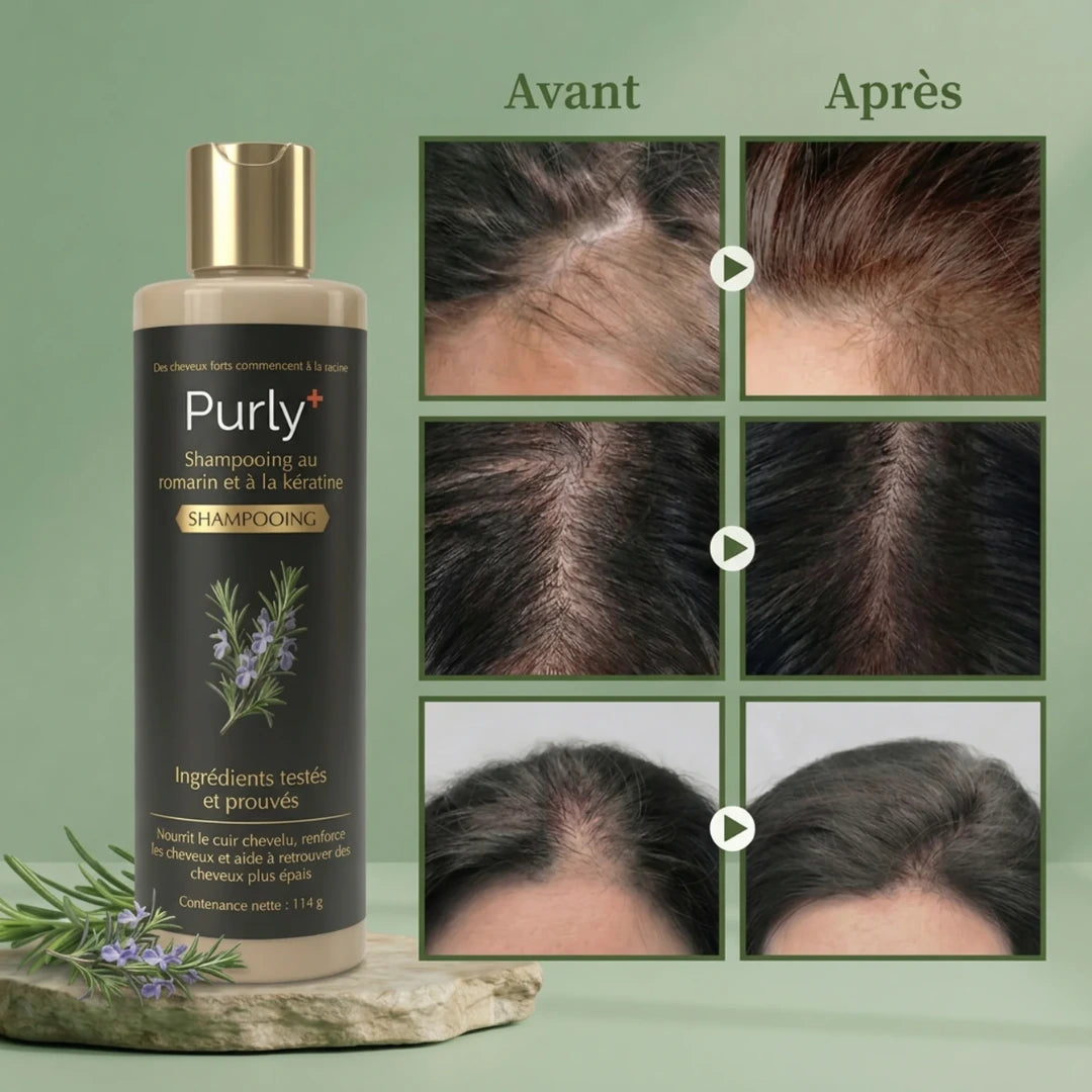 Purly™ Shampooing Fortifiant & Croissance