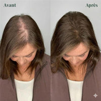 Purly™ Shampooing Fortifiant & Croissance