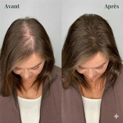 Purly™ Shampooing Fortifiant & Croissance