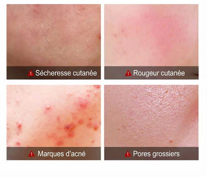 Crème à l'huile d'arbre à thé